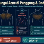 fungal acne di punggung dan dada ciri-ciri cara mengatasi beda dari jerawat badan biasa