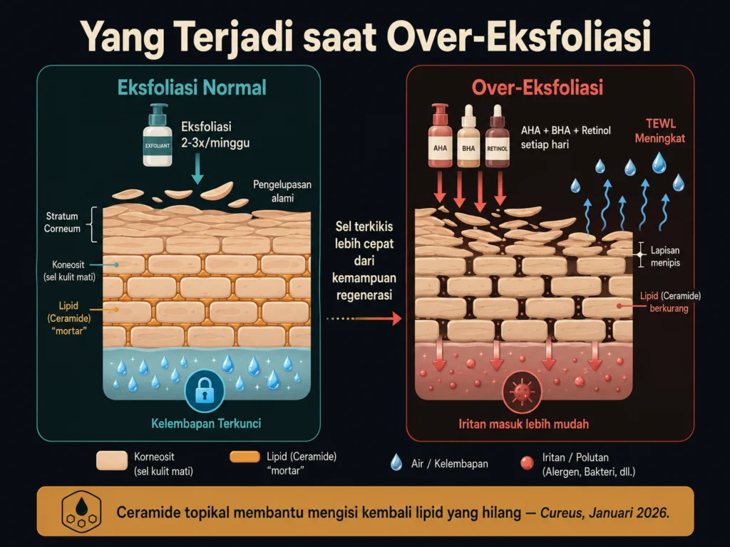 rutinitas pemulihan skin barrier over eksfoliasi 3 produk hentikan eksfoliasi cleanser ceramide sunscreen