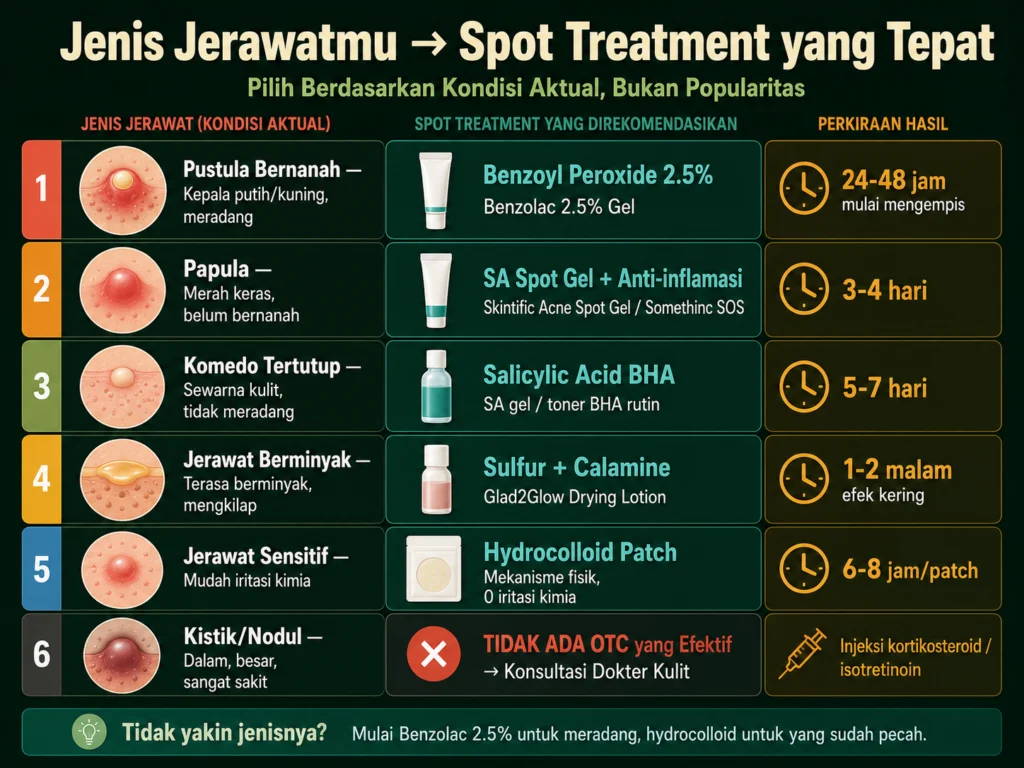 panduan memilih spot treatment berdasarkan jenis jerawat pustula papula komedo kistik